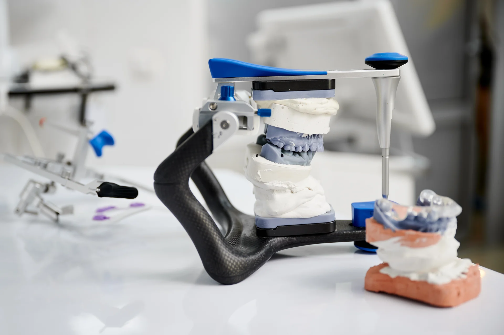 Detail of implant restoration designed around the patient's bite
