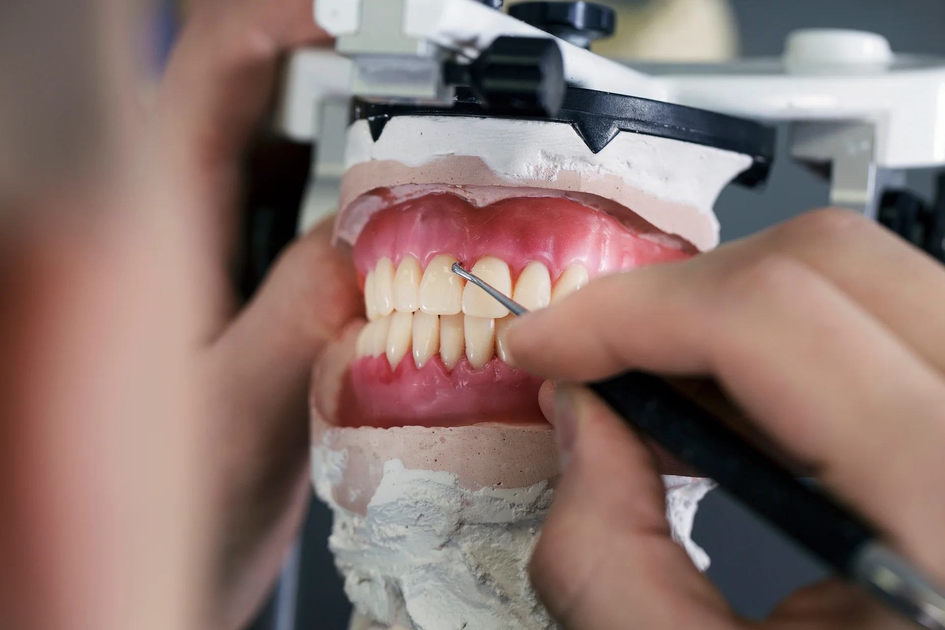Close-up of a full denture being refined on an articulator