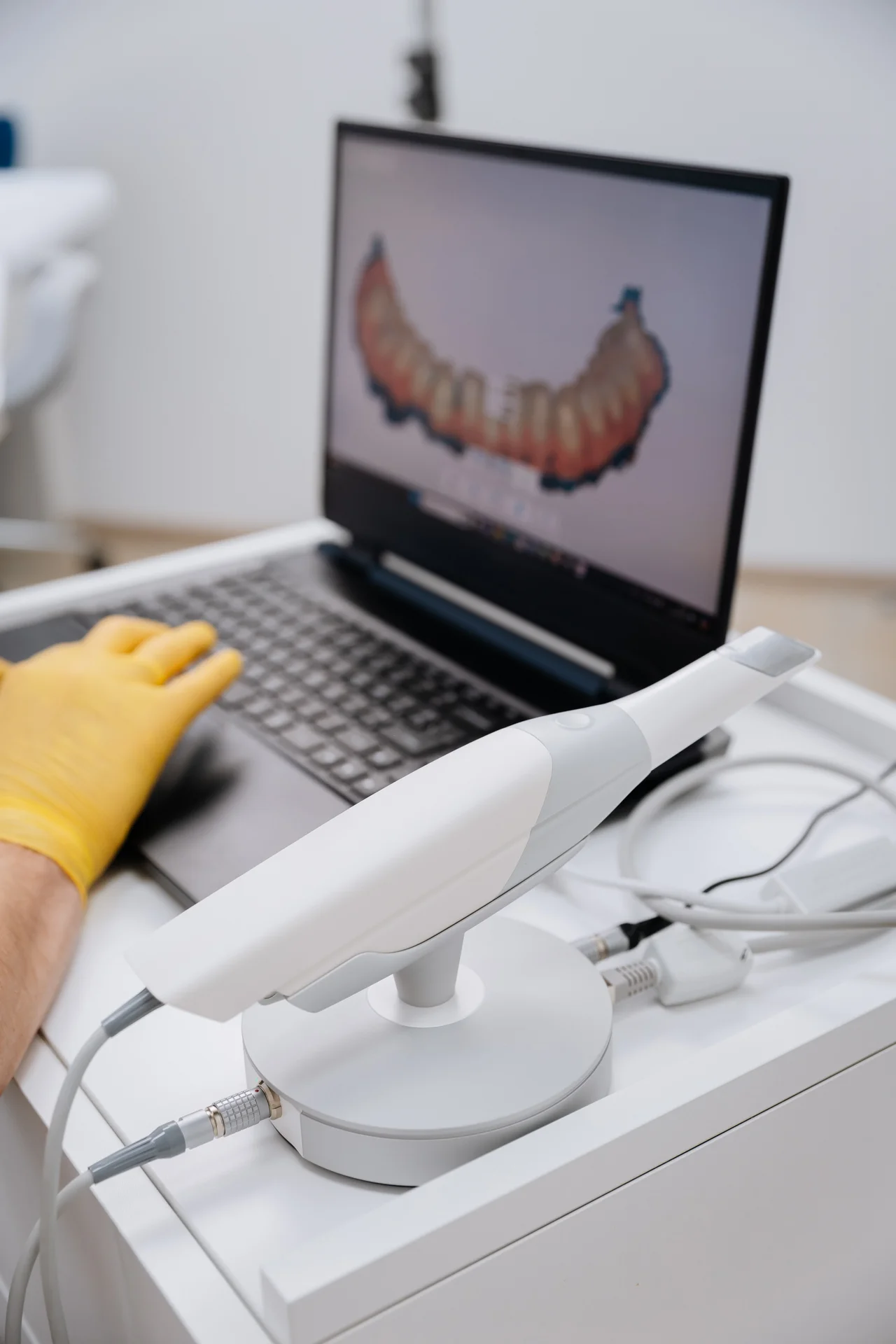 Intraoral scanner and laptop showing a digital dental impression