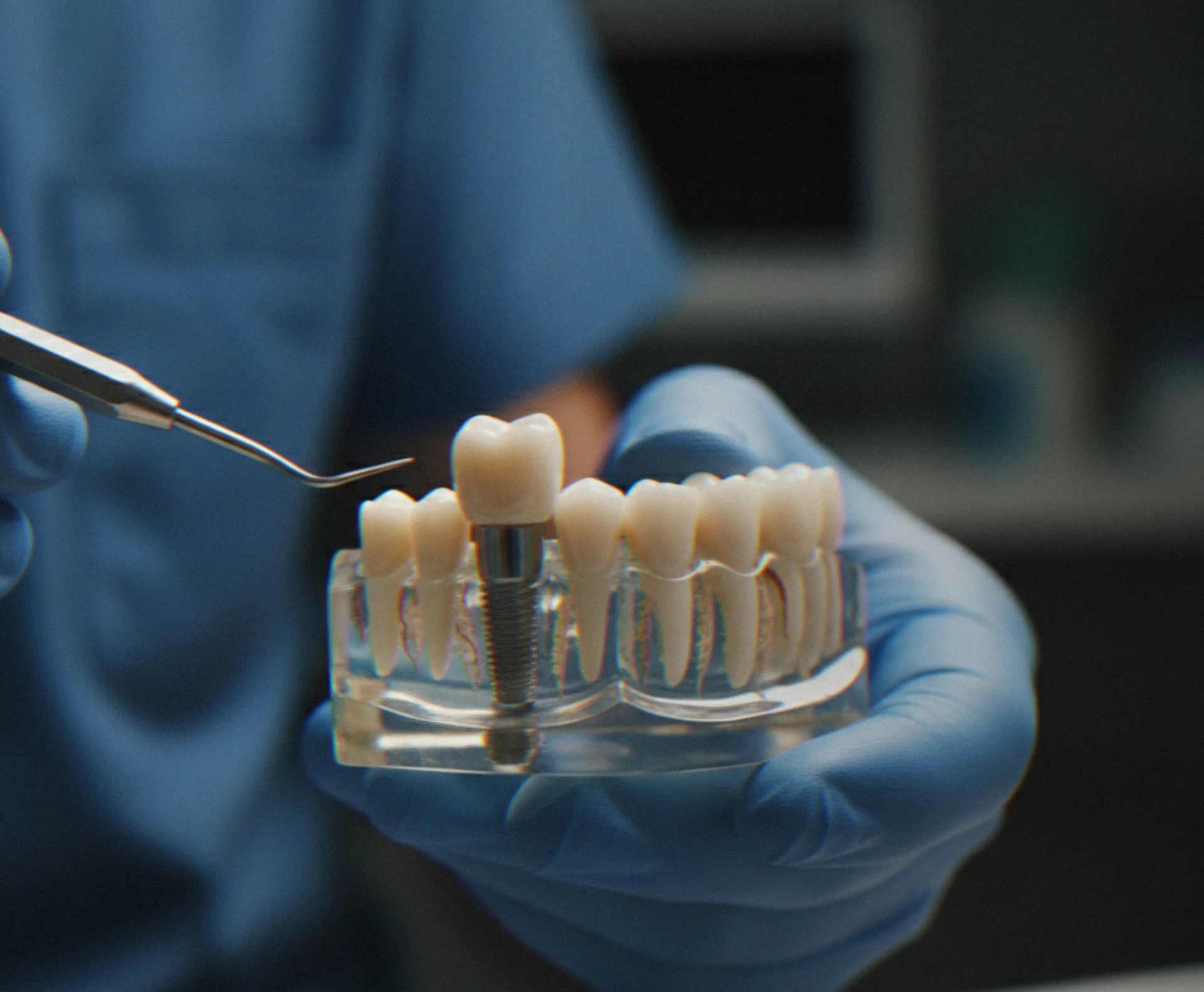 Dental implant model held during a prosthodontic consultation