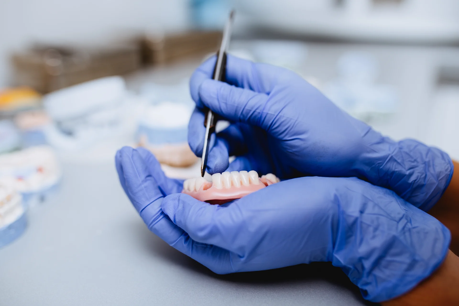 Implant-supported denture designed for a secure comfortable fit