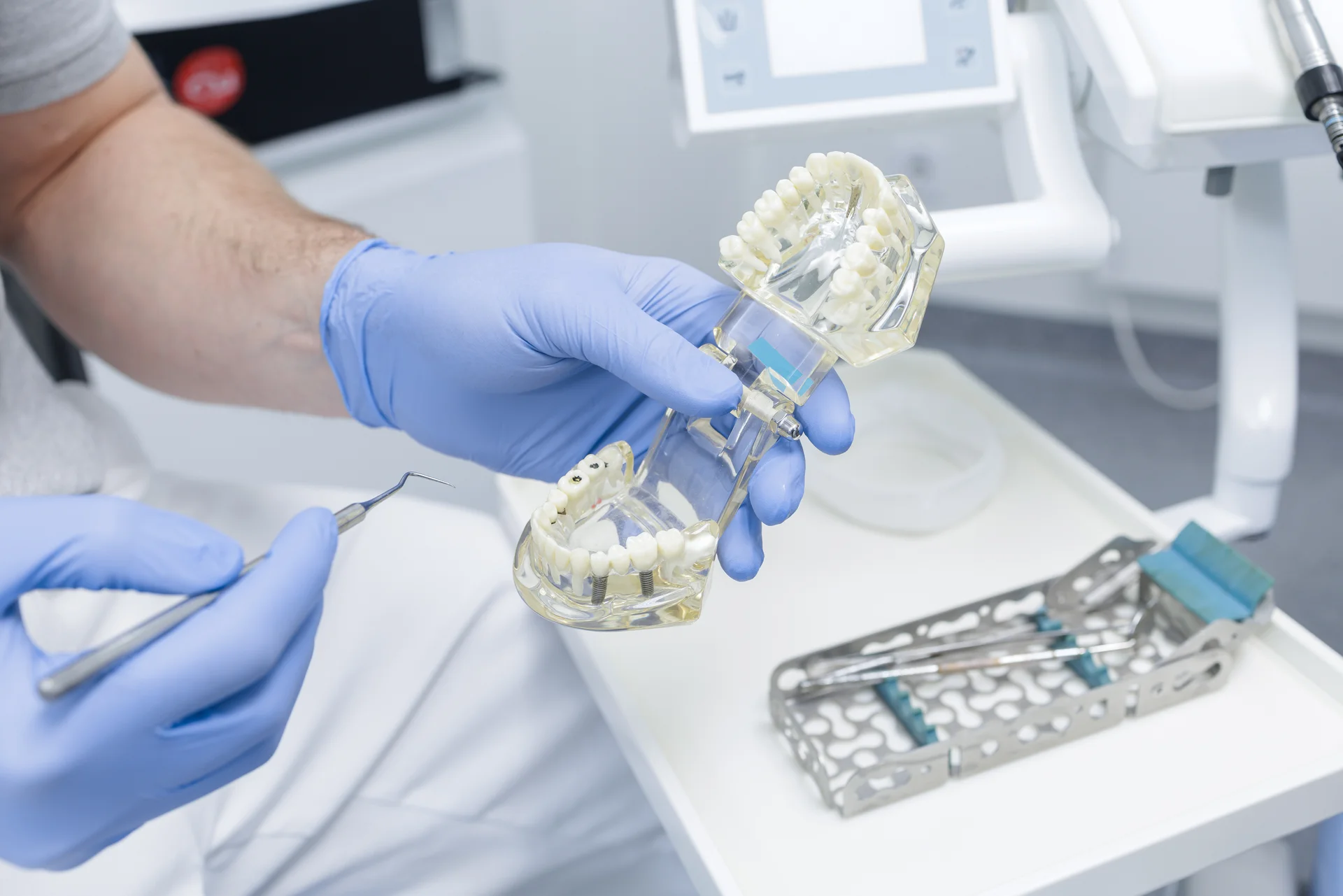 Full-arch All-on-X restoration planned around the whole mouth